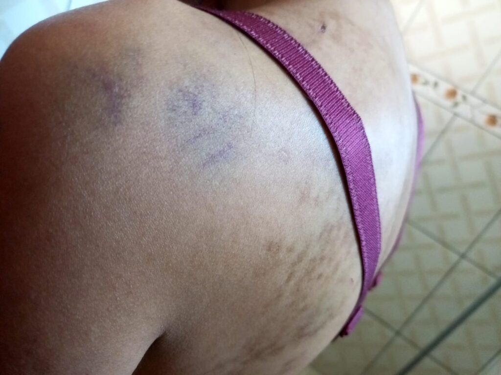 violência doméstica, violência contra a mulher, agressão